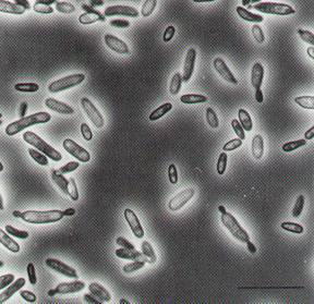 Blastospores of B. bassiana treated with larval secretion